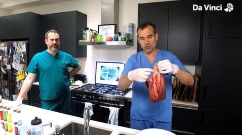 2. Lungs