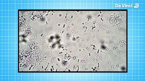 6. Bacteria